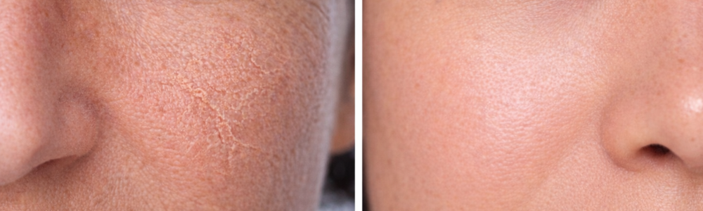 How Australian Climate Shapes Daily Skin Stress